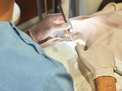 森本歯科の根管治療では光殺菌治療を行いますを表す画像