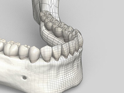 噛み合わせ治療