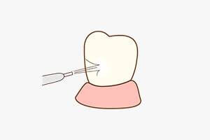 仕上げ磨きを表す画像